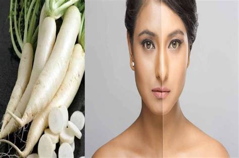 Skin Care Tips 1 मूली का नुस्खा बदल देगा चेहरे की रंगतमुंहासे होंगे गायब हर कोई पूछेगा