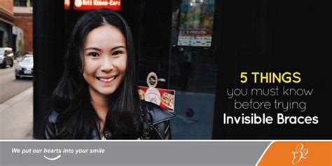 5 Things You Must Know Before Trying Invisible Braces