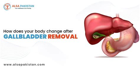 How Does Your Body Change After Gallbladder Removal