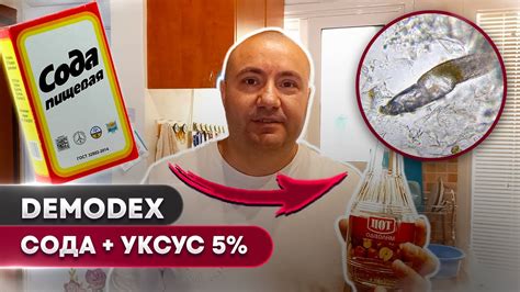 🐜 Сода против демодекса – сможет ли она убить клеща? 🔬🫧 # 1 - YouTube
