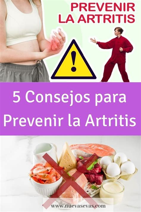 Cuando Te Diagnostican La Artritis Es Importante Recibir Consejos Con Ayuda De Expertos Para