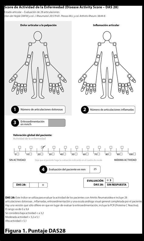 Disease Activity Score In Joints Pdf Off