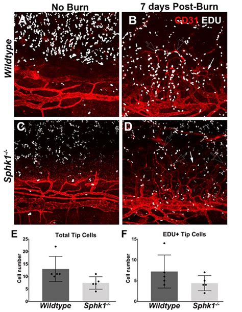 Ablation Of Sphk1 Does Not Affect The Numbers Of Total And