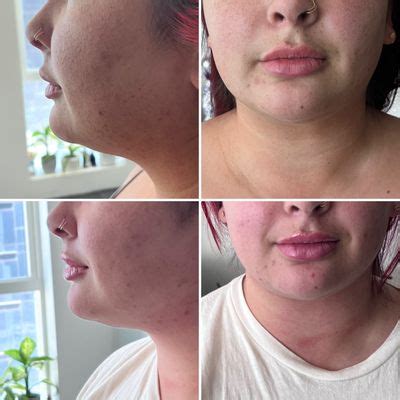 THE NUDE ME Updated March Gilroy California Body Contouring Phone Number Yelp