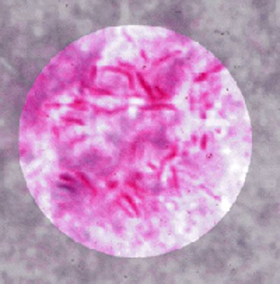 Lab 6 ACID FAST STAIN And Endospore STAIN Flashcards Quizlet