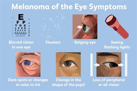 The Different Stages Of Eye Cancer Diagnosis And Treatment Options Ask The Nurse Expert