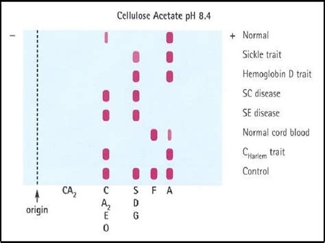 Practical Hematology Lab LAB 13 Hemoglobin Electrophoresis Electrophoresis