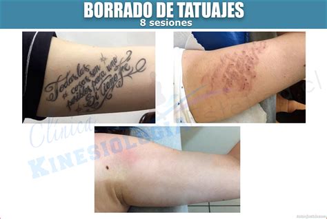 De Donde Viene La Tinta De Los Tatuajes Una Gu A Tatuajeclub