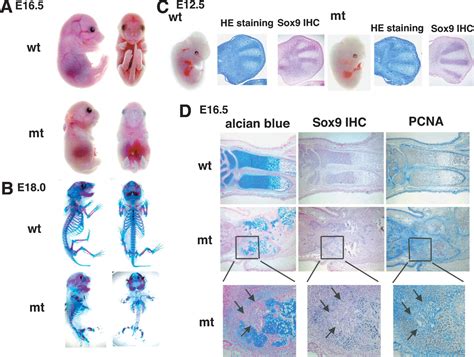 Interactions between Sox9 and β-catenin control chondrocyte differentiation 