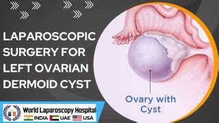 Laparoscopic Management Of Ruptured Ectopic Pregnancy Free