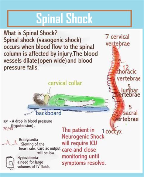 Pin On NCLEX Study