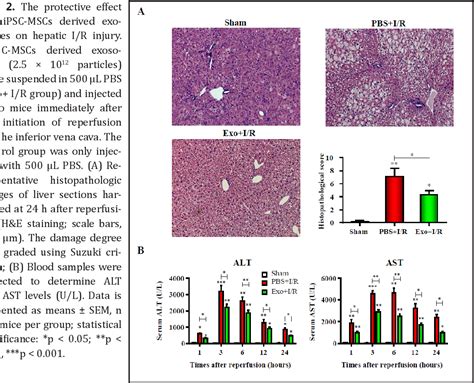 Figure From Exosomes From Human Induced Pluripotent Stem Cellderived