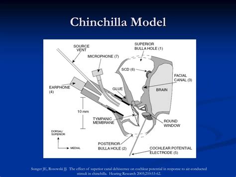 Ppt The Third Window Superior Semicircular Canal Dehiscence