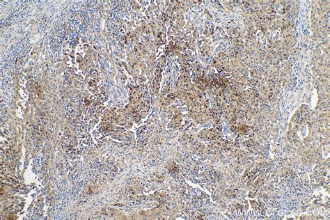 P Sqstm Antibody Rr Proteintech