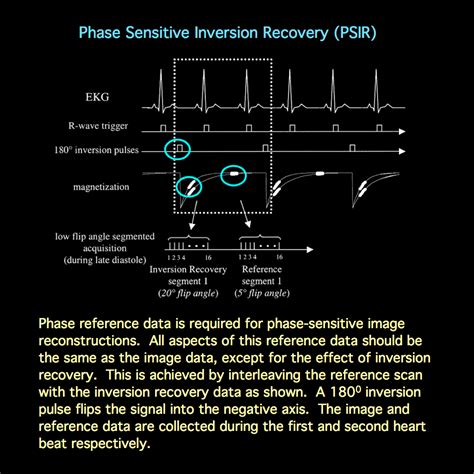 Mri Pulse Sequence Diagrams