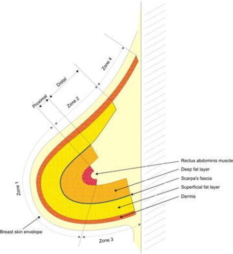 A Schematic Representation Of The Transverse Rectus Abdominis