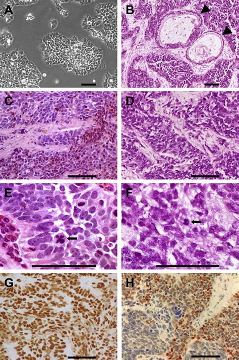 Morphology And Histology Of The 17 94 Wilms Tumor Cell Line A 17 94