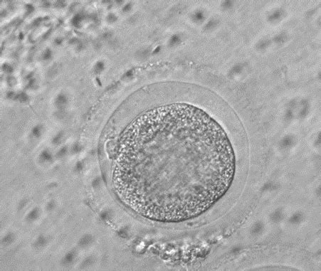 Oocyte With Polar Body Extrusion Post 22 H Of In Vitro Maturation