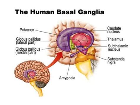 Basal ganglia stroke