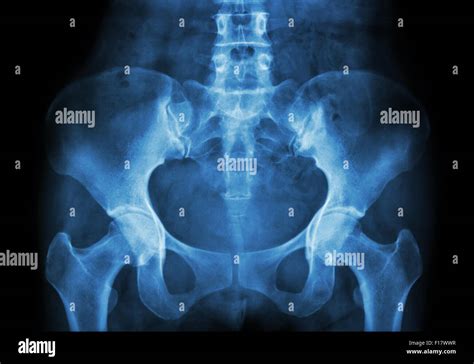 Radiolog A De Pelvis Fotograf As E Im Genes De Alta Resoluci N Alamy