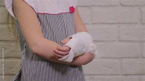 Close Up Of A Little Girls Broken Limb On A White Background The