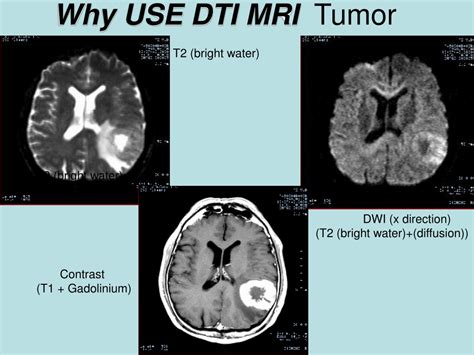 Ppt Dti Basics Water Diffusion Dti Diffusion Tensor Imaging