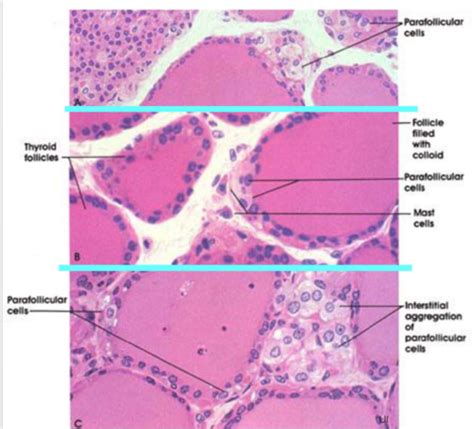 Thyroid Gland Slide Labeled Parafollicular Cells