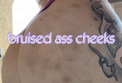 SammyyyStonerrr Bruised Ass Cheeks ManyVids
