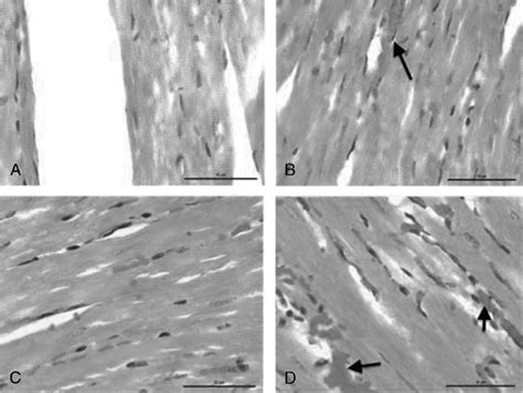 Histopathological Analysis After Dfe Treatment Histopathology Of