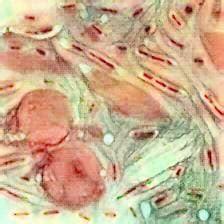 Morphology And Culture Characteristics Of Klebsiella Pneumoniae