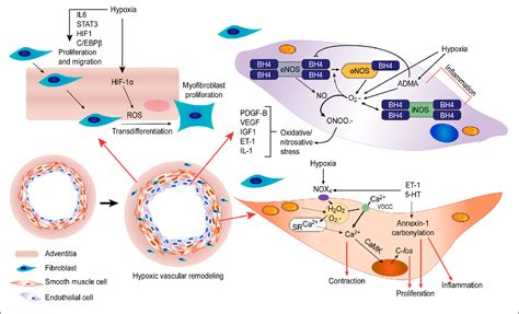 Figure 1 From Reactive Oxygen Species And Pulmonary Vasculature During