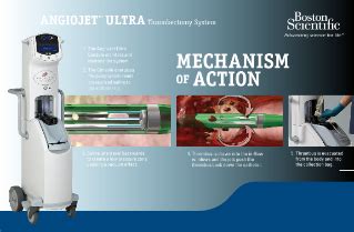 AngioJet™ Peripheral Thrombectomy System - Boston Scientific