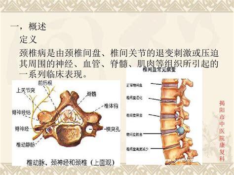 颈椎病防治word文档在线阅读与下载免费文档