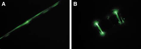 Identification of endothelial cells (EC) and smooth muscle cells (SMC ... 