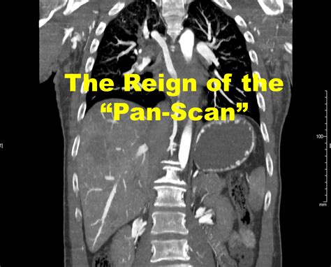 Emdocs Net Emergency Medicine Educationthe Reign Of The Pan Scan