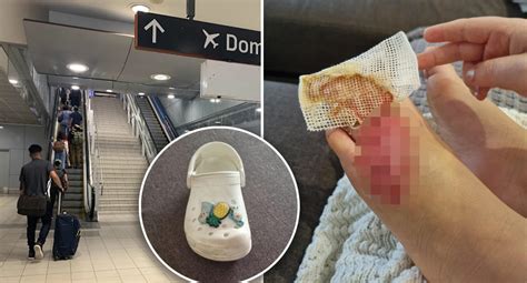 Girl S Shocking Escalator Injury At Sydney Airport Train Station