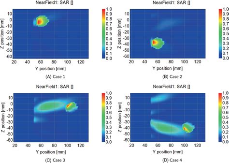 Tumor Normalized Specific Absorption Rate SAR Profiles For Different