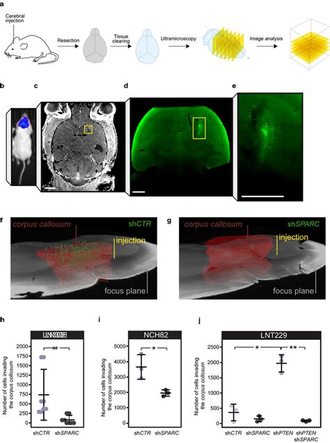 Glioblastoma Cells Require Sparc To Invade White Matter In Vivo A Spim