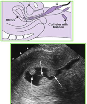 Ob Gyn Imaging Procedures Surgery In Gynecology Flashcards Quizlet