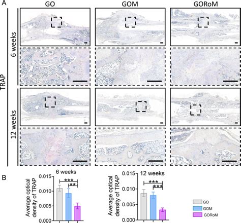 A Bone Adhesive Enhances Osteoporotic Fracture Repair By Regulating