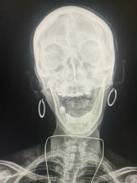 Crazy Xrays Of People, Creatures, & Things You've Probably Never Seen