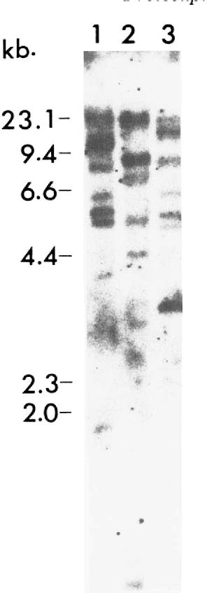 Figure From Molecular Cloning And Sequencing Of Cdnas Encoding The