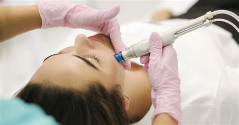 Microneedling Facial: Benefits, Cost, And Achieving A Youthful ...