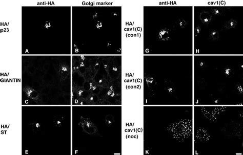 Colocalization Of HA Tagged Cav3 KSY With Golgi Markers And Caveolin In