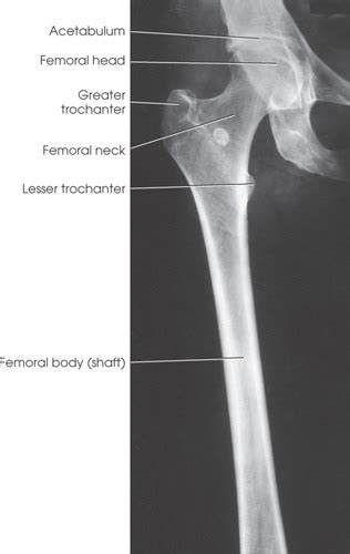 Positioning Proximal Lower Extremity Flashcards Quizlet