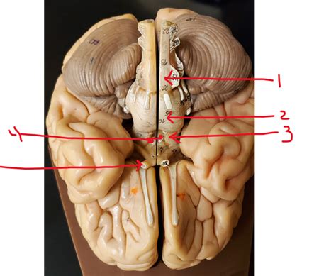 Anatomy Physiology Dorsal Brain View Diagram Quizlet