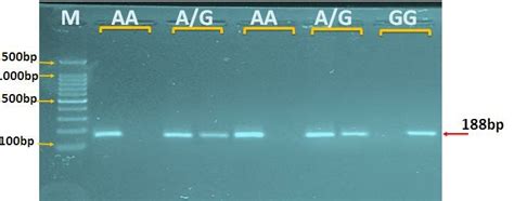 Agarose Gel Electrophoresis Image That Showed The Arms Pcr Product