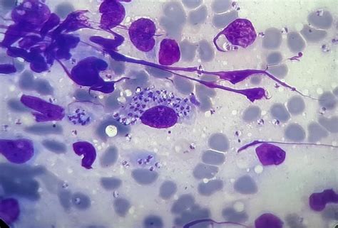 Leishmania Amastigote