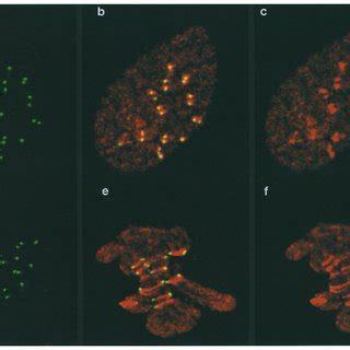 Comparative Localization Of Topo II And ACA In Prophase And Metaphase