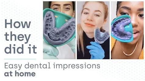 How They Did It Easy Dental Impressions At Home Youtube